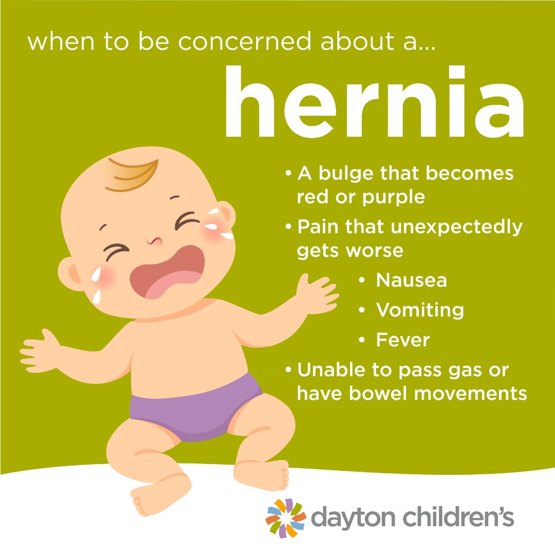 when to be concerned about a hernia | Dayton Children's Hospital